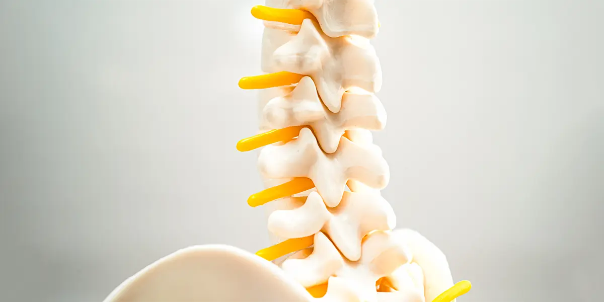 Spondilolisi e spondilolistesi